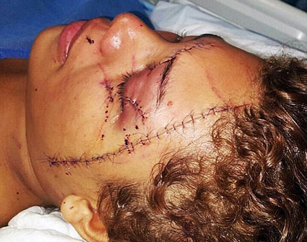 Une mannequin sauvagement battue par un groupe de femmes